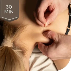 Akupunktio 30 min