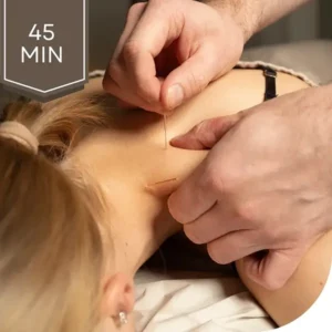 Akupunktio 45 min